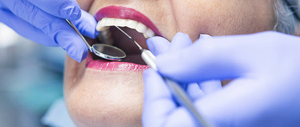 Best Emergency Wisdom Teeth Removal in Botkins, OH