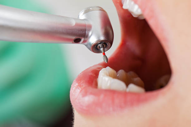 Best Urgent Care for Lost Fillings or Crowns in Botkins, OH